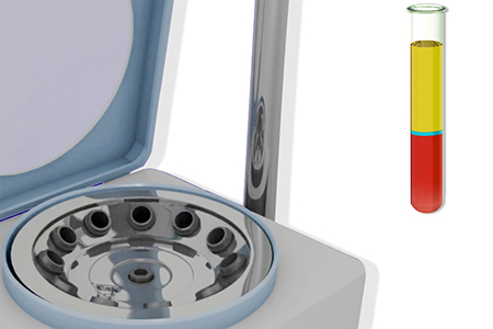 Platelet-Rich Plasma (PRP) Injections